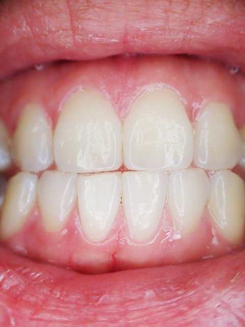 ألم اللثة تحت الأسنان: أسباب ‏وطرق ‏العلاج