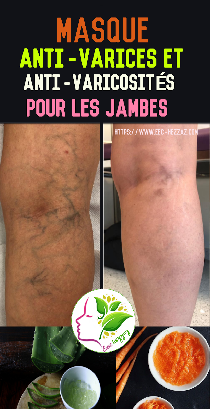 Masque anti-varices et anti-varicosités pour les jambes