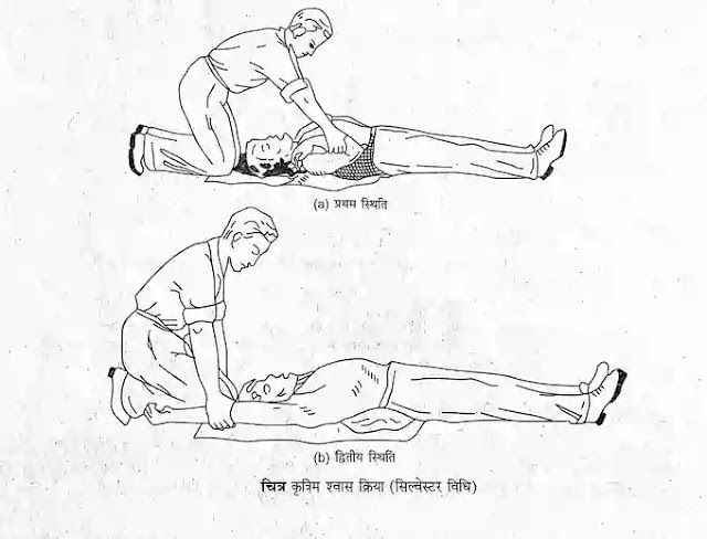 मुँह-से-मुँह में हवा भरना विधि मुँह-से-मुँह में हवा भरना विधि