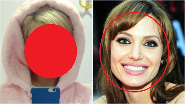 Heboh !!! Wanita di Iran Operasi Wajah 50 Kali supaya Mirip Angelina Jolie Tapi Gagal