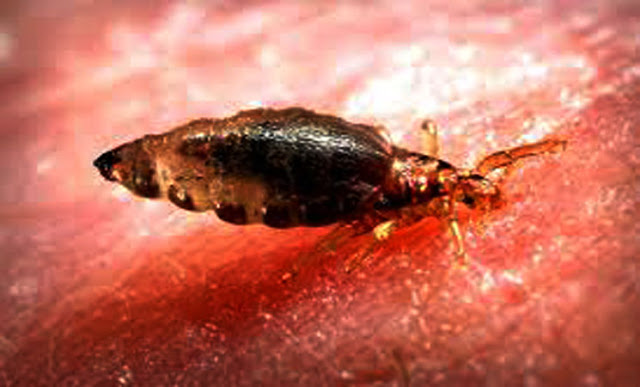 5 Cara Menghilangkan Kutu di Rambut Secara Alami Dengan Cepat - Ato