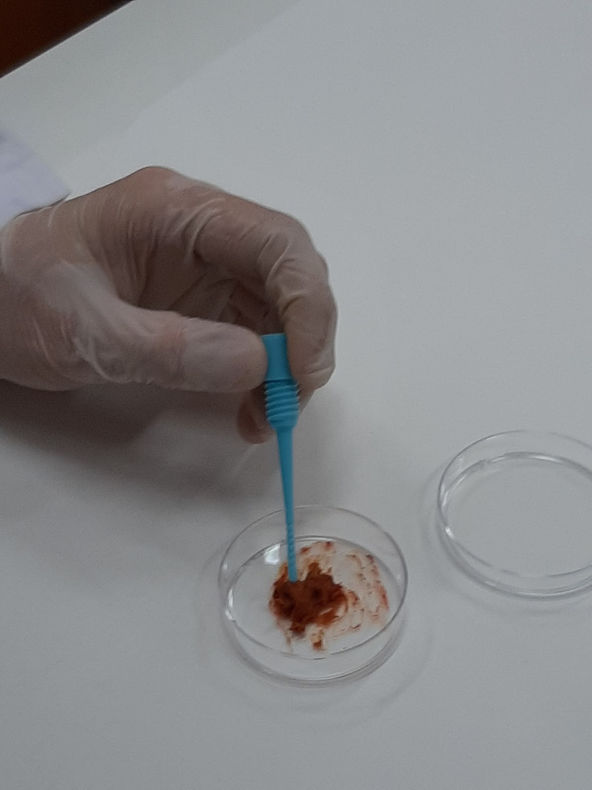 PRÁCTICA 23 DETERMINACIÓN CUALITATIVA DE SANGRE OCULTA EN HECES POR INMUNOCROMATOGRAFÍA