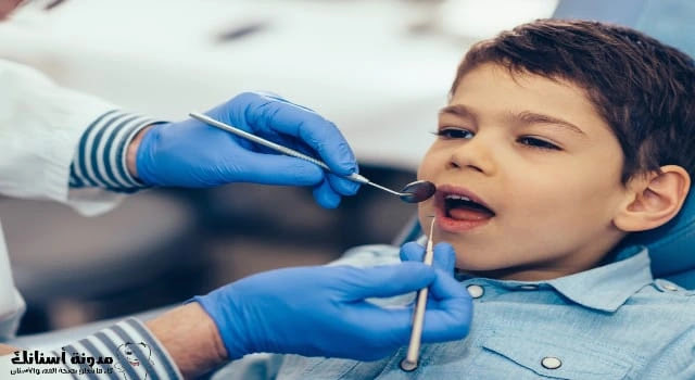 علاج التسوس عند الأطفال - تسوس الأسنان اللبنية.
