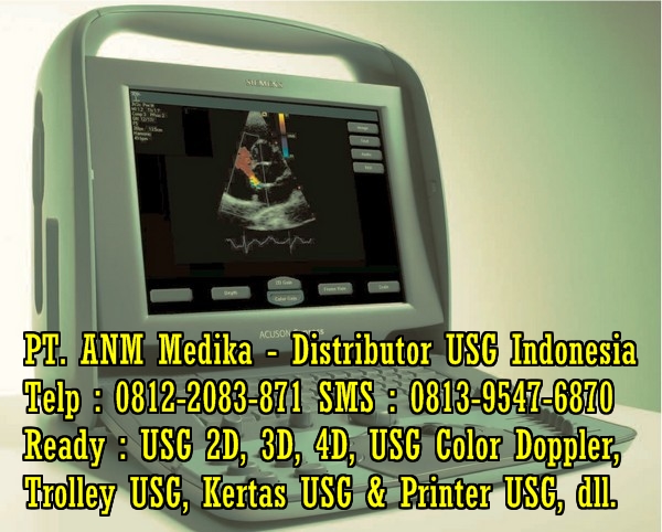 Harga Alat USG 2d Harga-usg-aloka