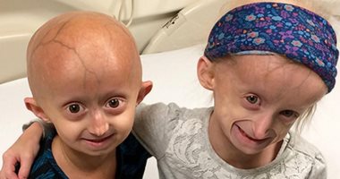 ما هو مرض شيخوخة الطفل؟ ما هو مرض شيخوخة الطفل؟