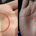 Letter X On Their Both Hands: Here’s What It Means About Your Future, Destiny And Personality