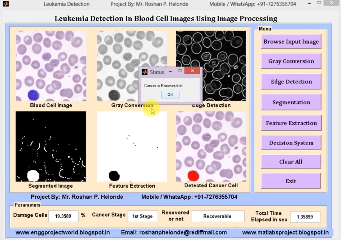 Early Stage Leukemia Blood Cancer Detection Using Matlab Source Code ...