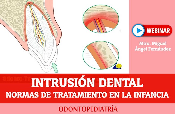 INTRUSIÓN DENTAL: Normas de tratamiento en la infancia - Mtro. Miguel Ángel Fernández