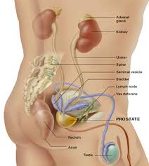 Prostate Cancer Picture