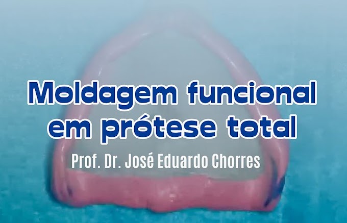 PRÓTESE DENTAL: Moldagem funcional em Prótese Total - Prof. Dr. José Eduardo Chorres