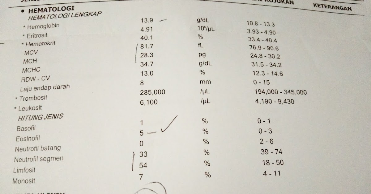 Anak Bisa Alergi Karena Kekurangan Vitamin D
