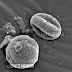 Wordless Wednesday: Pollen bunga dibawah mikroskop