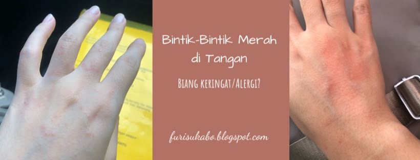 Bintik-Bintik Merah di Tangan - Biang Keringat/Alergi? - A Little Thing