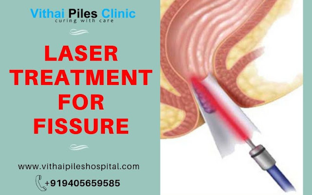 laser treatment for fissure, treatment for fissure in ano, fissure treatment in Pune, best fissure doctor in Pune, ayurvedic treatment for fissure in Pune, laser treatment for fissure in Pune, laser treatment for fissure PCMC, Fissure In Ano