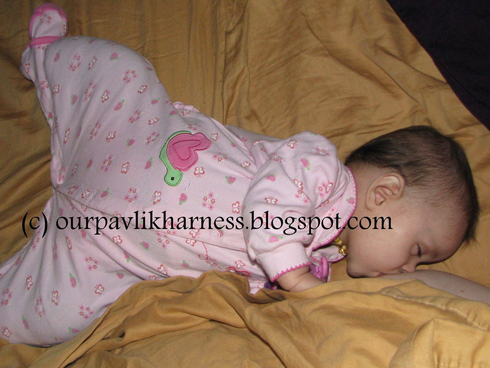 Our Pavlik Harness and journey with Hip Dysplasia Feeding the Spica