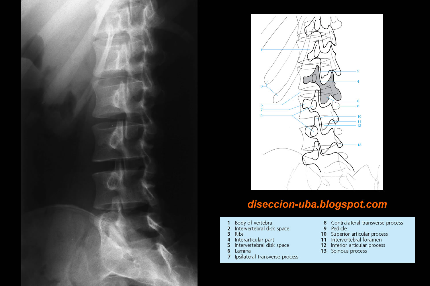 rx: Rx columna lumbar oblicua