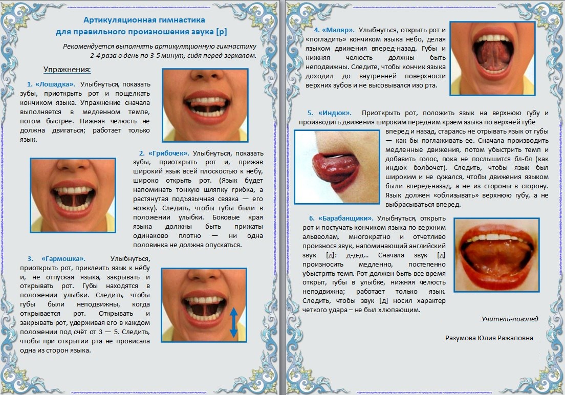 Арт гимнастика в картинках