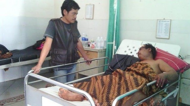 Akibat Nikah Siri Tanpa Ijin, “Burun9” Pria Ini di Potong Sama Istri Pertamanya Akibat%2BNikah%2BSiri%2BTanpa%2BIjin