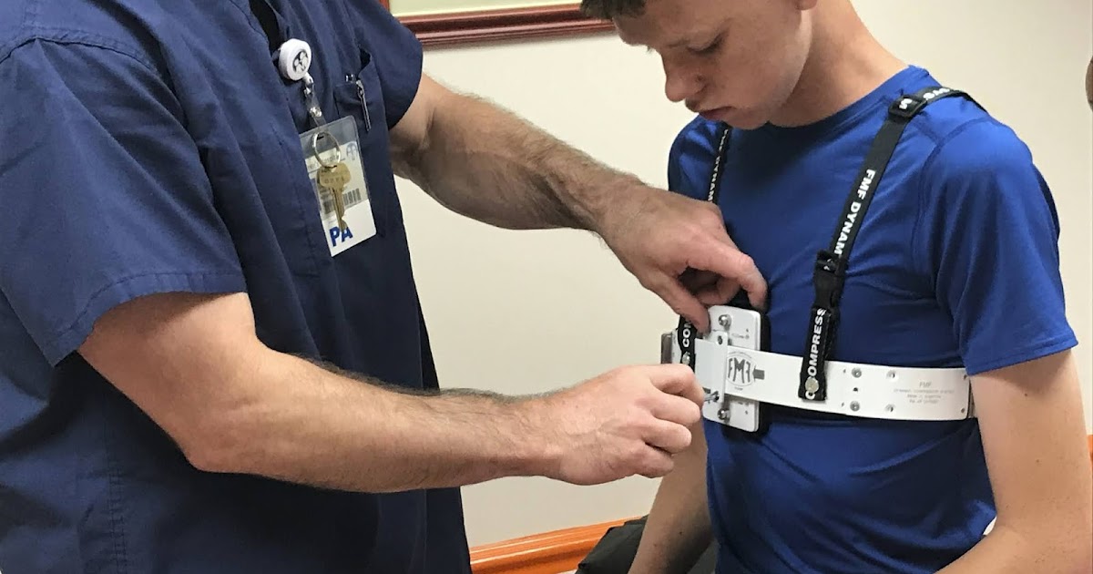 Pigeon Chest Images, Symptoms, Causes, Brace, Treatment Health Care Tips and Natural Remedies