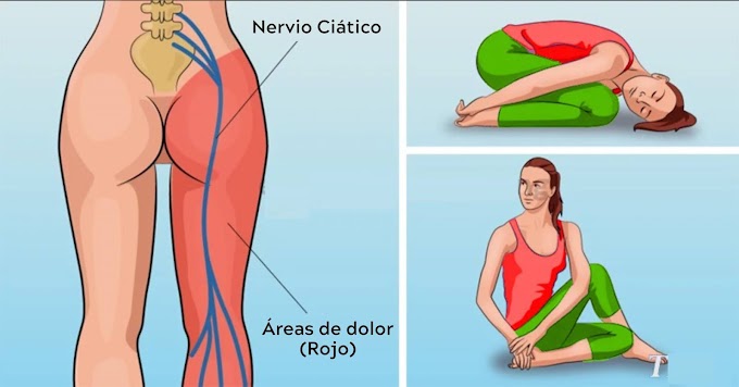 8 posturas de yoga para eliminar el dolor de ciática