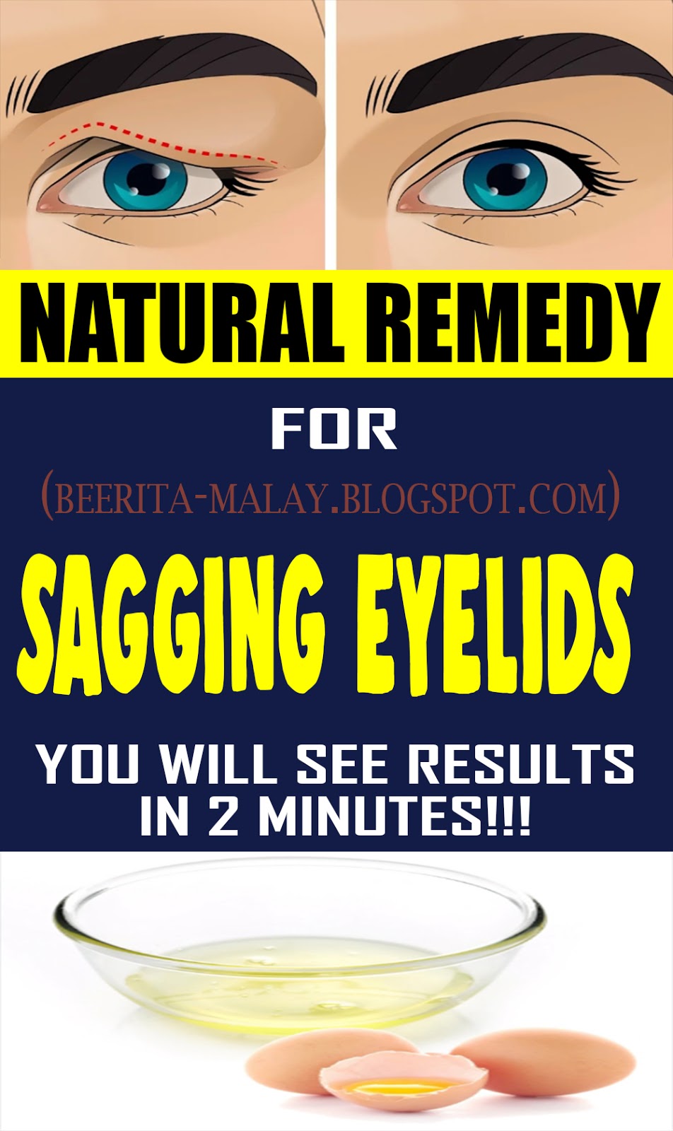 Natural Remedy For Sagging Eyelids You Will See Results In 2 Minutes HEALTH and WELLNESS