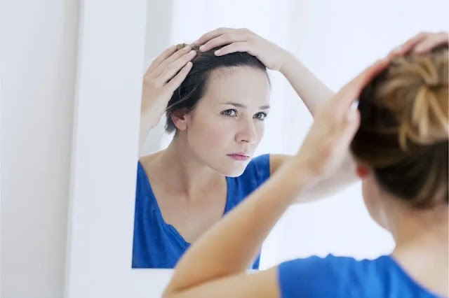 Common causes of hair loss in women Common causes of hair loss in women
