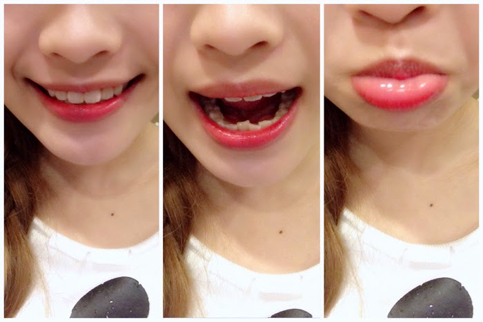 teeth crooked smile slightly really row tlc journey open mouth tooth dental centre problems don