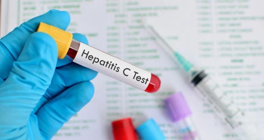 Sintomas e Sinais de Alerta da Hepatite C