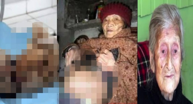 Netizen Terkejut Wanita Mengandung Anak Mumia