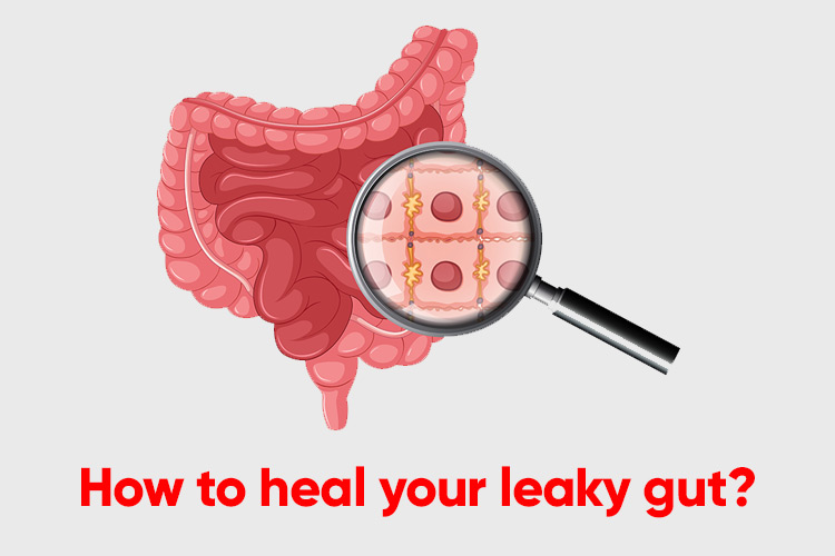 How to heal your leaky gut How to heal your leaky gut