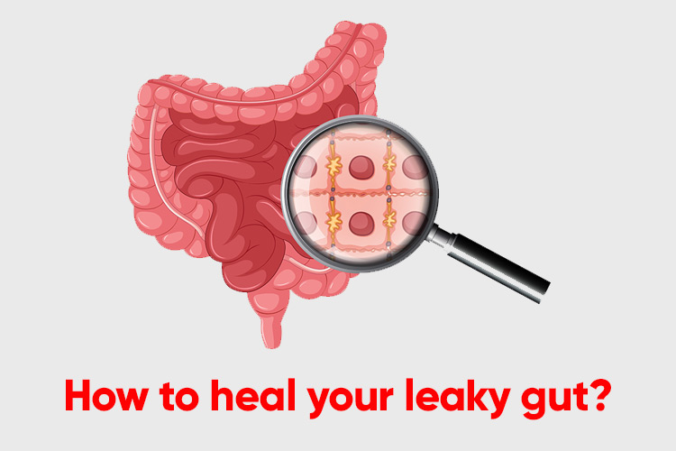 How to heal your leaky gut