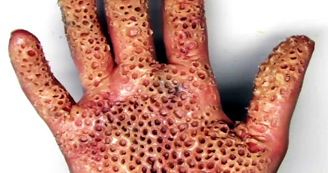 20 list of weird phobias types ! Maybe you Have One of Them ! 20 list of weird phobias types ! Maybe you Have One of Them !