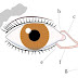 What is Dry Eye Syndrome (keratoconjunctivitis Sicca)