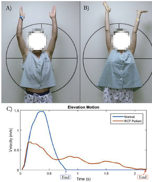 UW Shoulder and Elbow Academy Shoulder range of motion objective