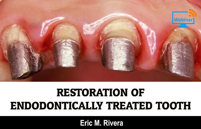 CONFERENCE: Restoration Of Endodontically Treated Tooth - Eric M. Rivera