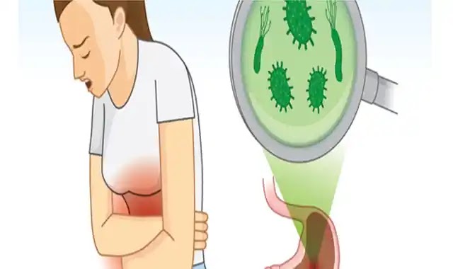معدل بكتيريا المعدة وكيفية علاجها