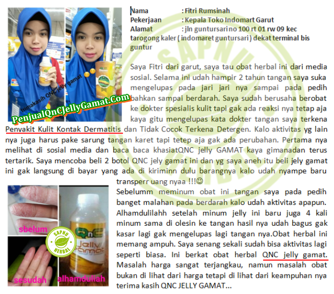 Cara Mengobati Gatal Di Ketiak Dan Selangkangan Secara Alami Terbukti Manjur ~ TESTIMONI QNC JELLY GAMAT Cara Mengobati Gatal Di Ketiak Dan Selangkangan Secara Alami Terbukti Manjur ~ TESTIMONI QNC JELLY GAMAT