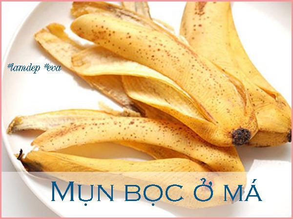 Làm theo cách này hằng ngày đánh bay mụn bọc Làm theo cách này hằng ngày đánh bay mụn bọc