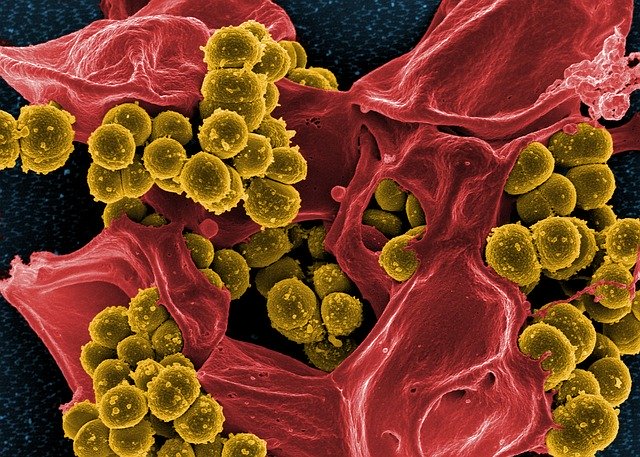 المناعة / تعريف المناعة و آليات الجهاز المناعي