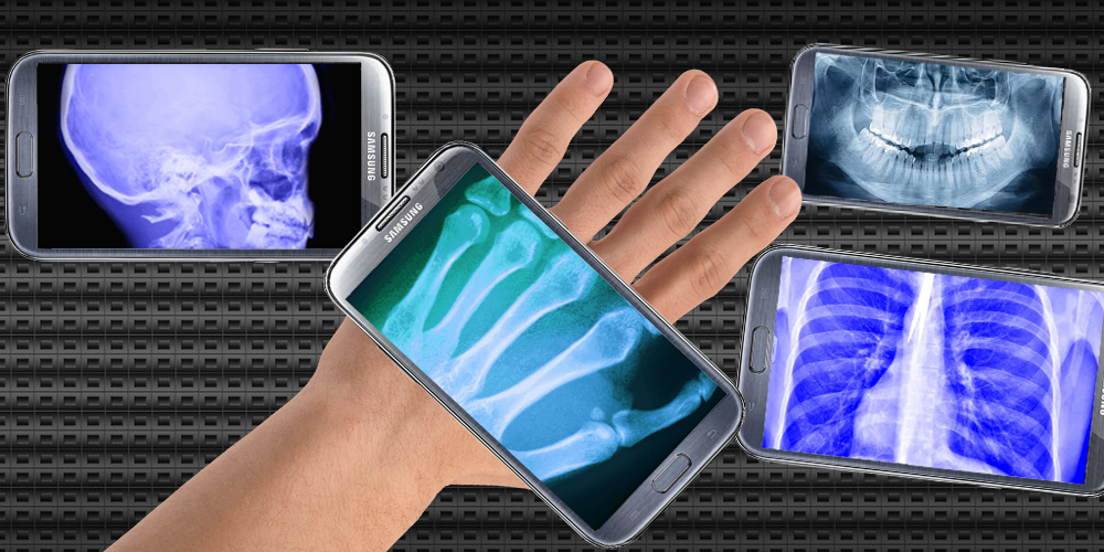 Девушка со сканером. Приложение xray scan v 3. Приложение xray scan v 3. Рентген сканер. Девушка со сканером.