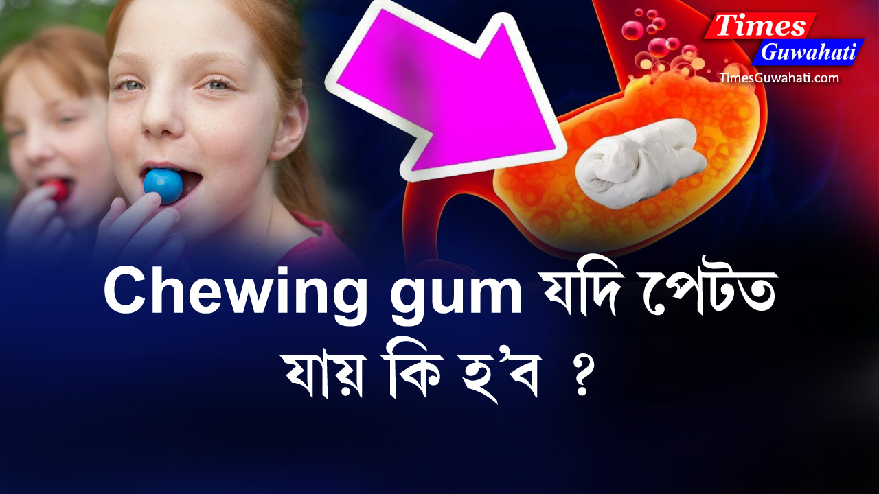 Chewing gum গিলি দিলে আপোনাৰ মৃত্যু হ'ব পাৰে নেকি What happen if