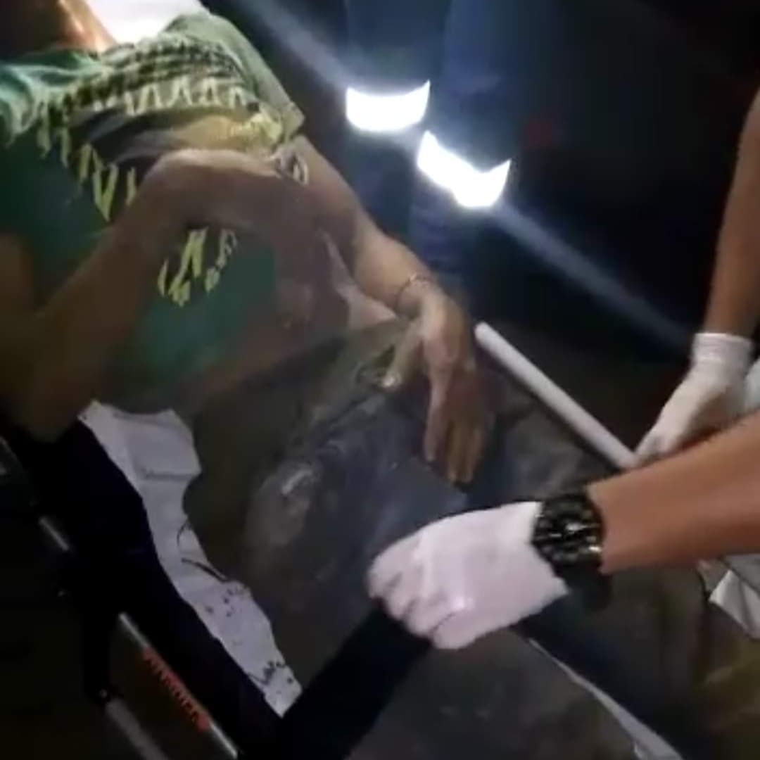 Adolescente é encontrado baleado no quintal de uma residência na Palmares I.