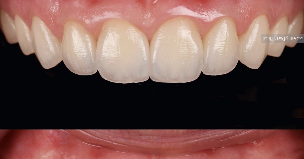 DENTISTRY Structure of Gingiva