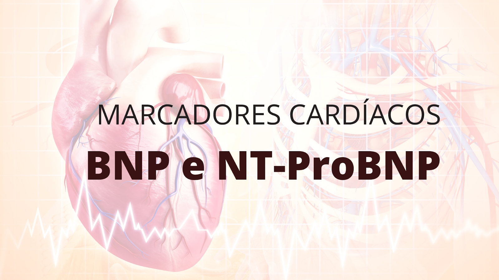 BNP e NTproBNP Tira o Jaleco