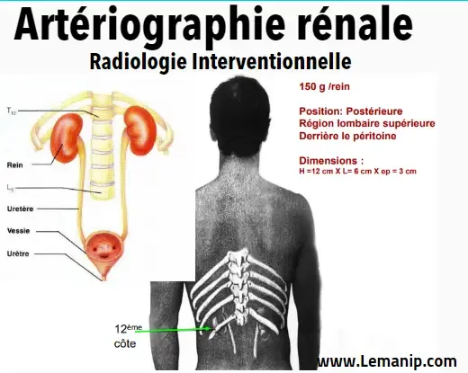 Définition  d'une artériographie rénale