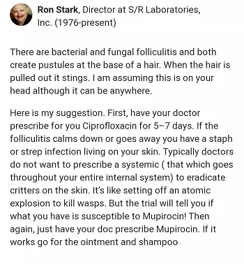 Scalp Folliculitis Treatment Scalp Folliculitis Treatment