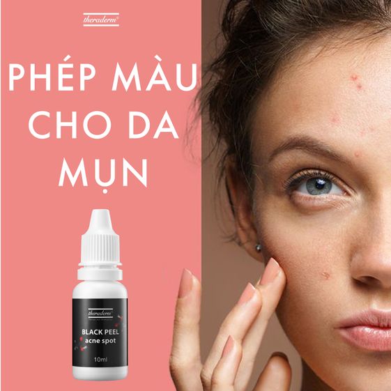 SERUM CHẤM MỤN BLACK PEEL ACNE SPOT - THERADERM 8 sm 433485623778 1647332273364