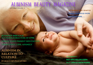 Albinism Beauty Magazine