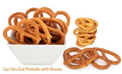 Can You Eat Pretzels with Braces