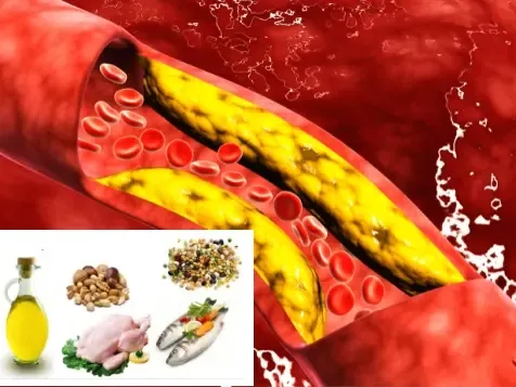 Lower Cholesterol with a Low Fat Diet Lower Cholesterol with a Low Fat Diet